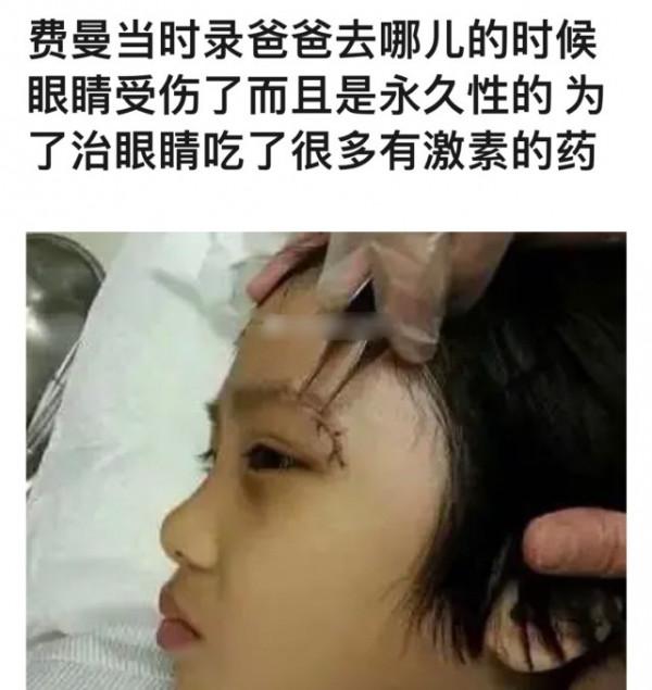 吳鎮宇兒子費曼近照曝光，變胖網友表示認不出，五官精緻似母親