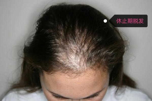 【頭等大事,你瞭解多少?】 【頭等大事,你瞭解多少?】