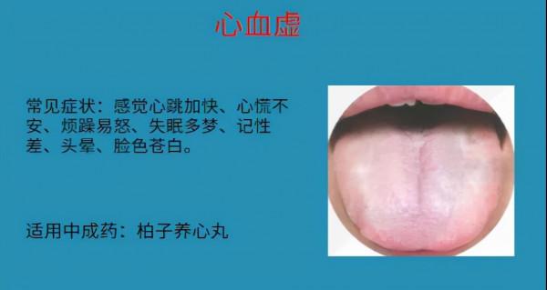 怕冷就補陽？血虛也會！6種血虛情況，實用中成藥大總結