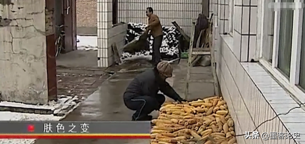 真實故事:山西45歲女子一夜變黑,體重急速增加,手術後讓家人落淚