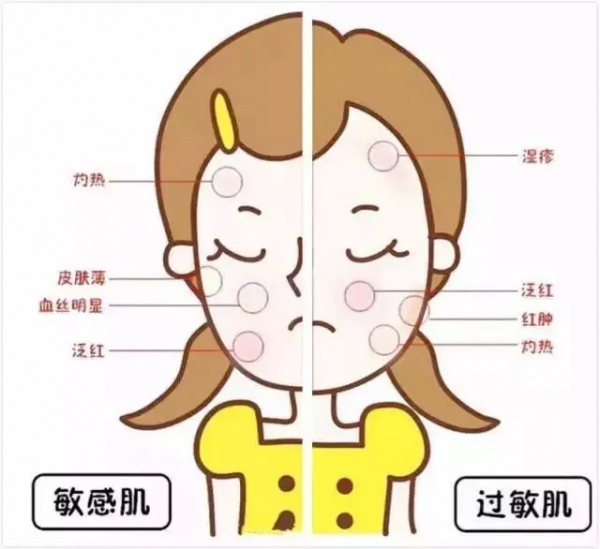 一入秋就過敏？拯救敏感肌，這份秋季“護膚攻略”請收好