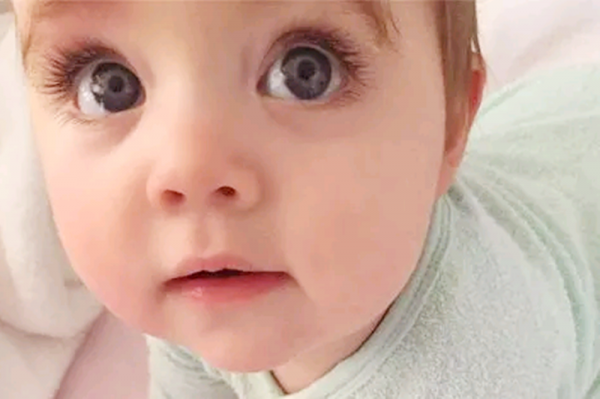 想孩子出生後眼睛好看，是個大眼萌娃，孕期建議媽媽多吃兩種水果