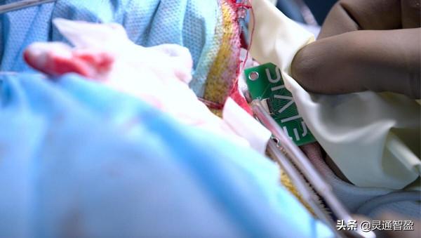 俄羅斯科學家成功將視覺植入猴子體內