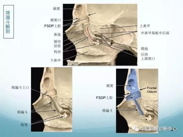 頭頸五官CT斷層解剖圖及常見病影像診斷