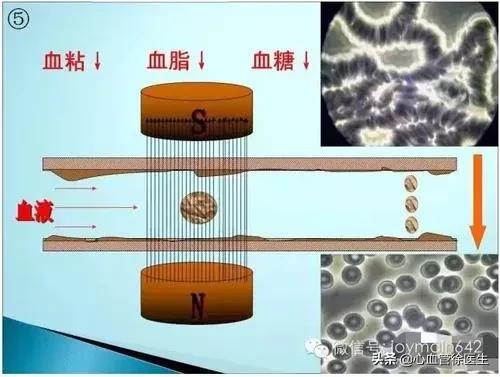 血液粘稠怎麼調理?醫生卻說,不要再被矇蔽了 血液粘稠怎麼調理?醫生卻說,不要再被矇蔽了