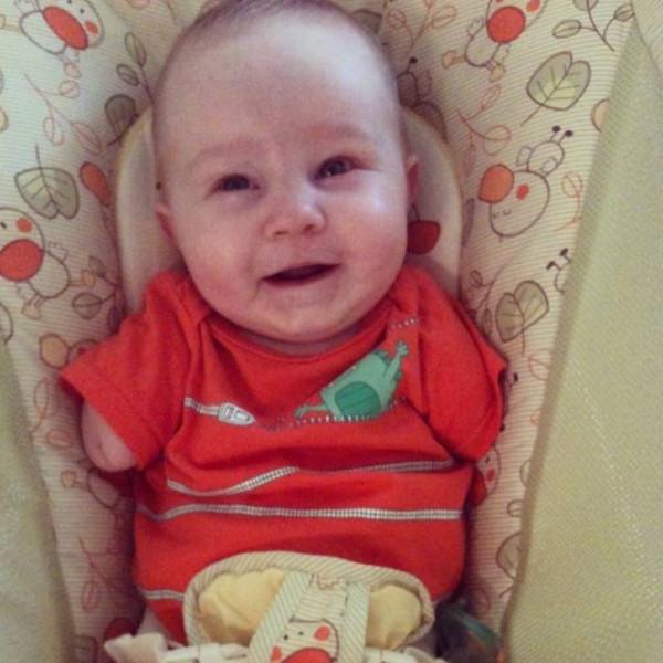 B超嬰兒無四肢,18歲媽媽拒絕墮胎,冒險生子,把孩子養成男子漢 B超嬰兒無四肢,18歲媽媽拒絕墮胎,冒險生子,把孩子養成男子漢