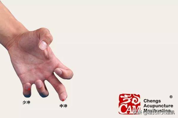 程凱養生說：心血不足，手上有表現