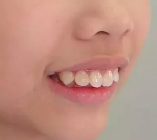 這幾個小習慣不改掉,小心娃會變醜受罪還費錢 這幾個小習慣不改掉,小心娃會變醜受罪還費錢