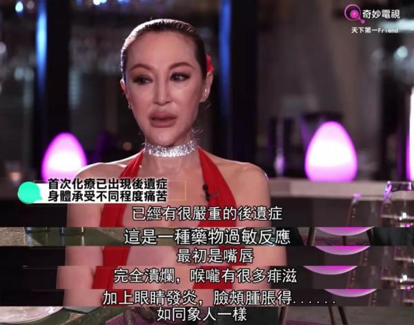 繼承鉅額遺產後嫁入豪門，又遭毀容，闊太薛芷倫經歷了什麼？