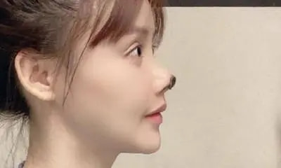 5位“毀容”的明星,胡歌“鬼門關”逃了出來,王心凌令人惋惜 5位“毀容”的明星,胡歌“鬼門關”逃了出來,王心凌令人惋惜