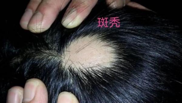 【頭等大事,你瞭解多少?】 【頭等大事,你瞭解多少?】