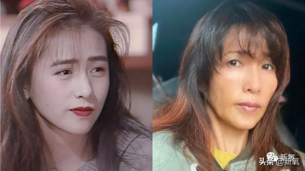 為什麼有人瘦了反而變得更醜? 為什麼有人瘦了反而變得更醜?