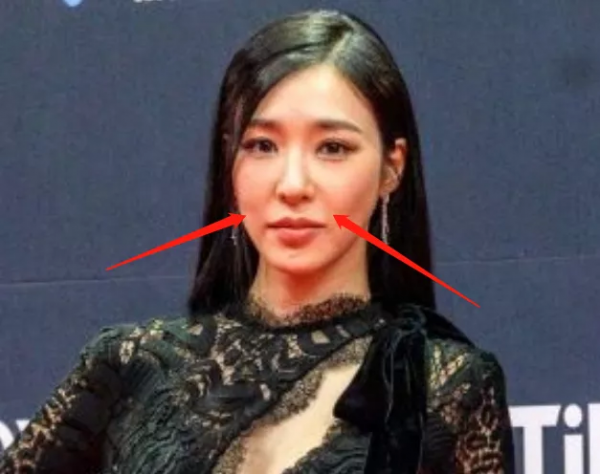 好多整容臉！外網曝韓國頒獎禮生圖，明星動鼻子後遺症太明顯