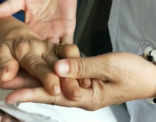 吃了一個月抗風溼藥不見效，類風溼患者想換藥，該換嗎？