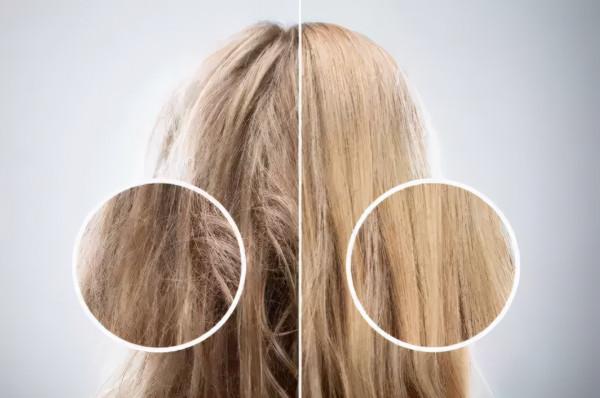 戴假髮需要注意什麼?假髮的常見問題 戴假髮需要注意什麼?假髮的常見問題