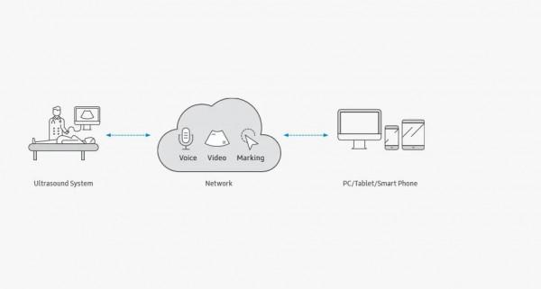 三星醫療高階超聲診斷系統&mdash;&mdash;RS85 Prestige
