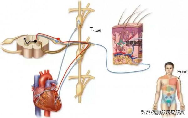 神經受壓產生的不只有疼痛,還有情緒和精神的改變 神經受壓產生的不只有疼痛,還有情緒和精神的改變