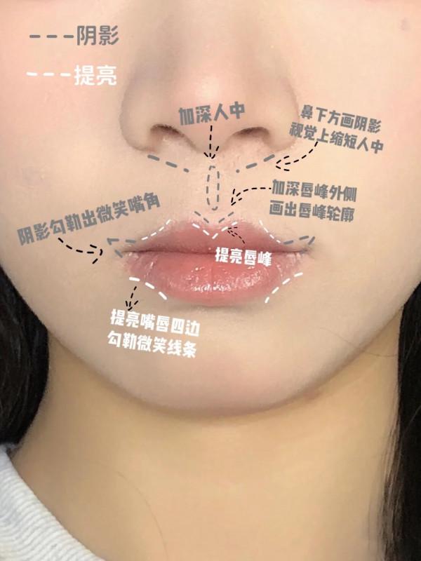 乾貨，改善凸嘴&sol;長人中，人中縮短大法