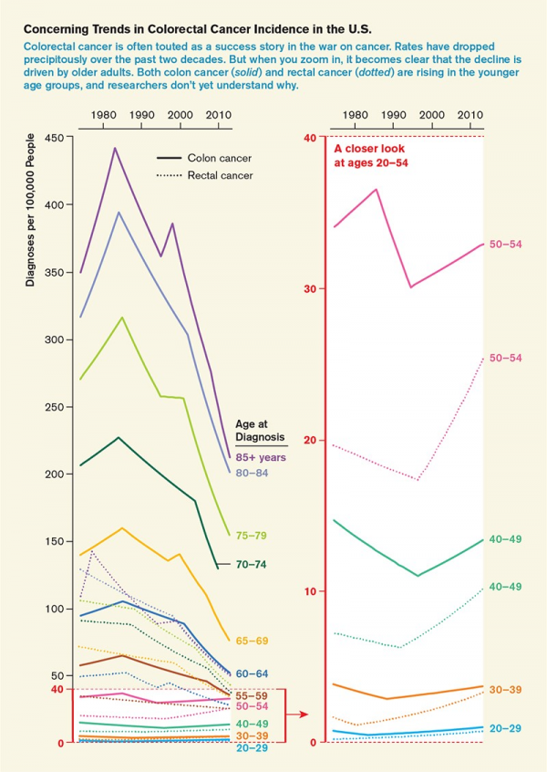 Nature：結直腸癌發病年輕化，篩查難題如何解？