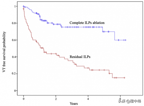 基質消融術：器質性心臟病室速治療方法