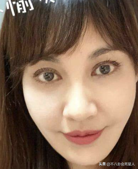 中年女星整容後遺症一堆！臉像鞋拔子，不敢做大表情，演戲沒法看