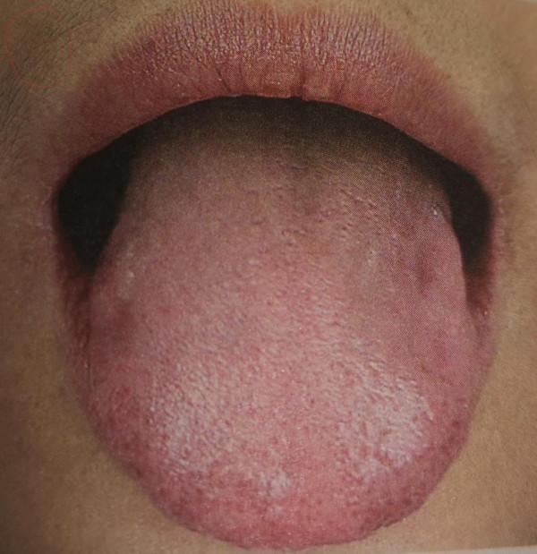 血瘀生百病，一張圖辨別自己是不是血瘀體質