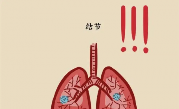 肺內磨玻璃密度影怎麼回事？