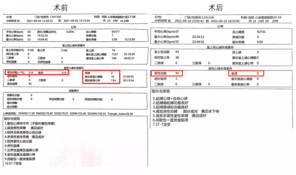 仁醫新術丨江西首例ECMO支援下室速射頻消融術在省人民醫院開展