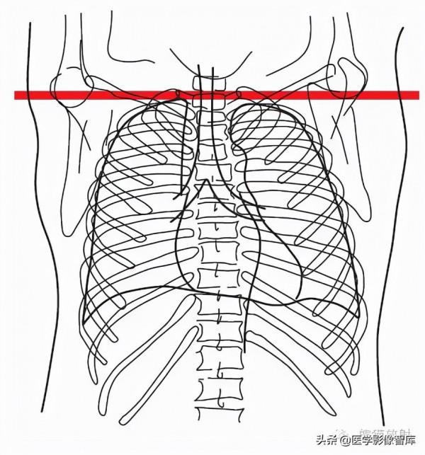 CT斷層解剖圖譜最全總結「推薦收藏」 CT斷層解剖圖譜最全總結「推薦收藏」