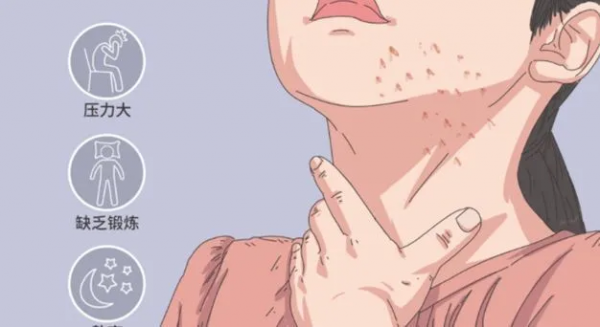 面板上長了“小肉球”,或許是尋常疣