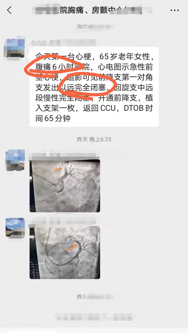 連續搶救2位心梗：1個咽痛1個腹痛！如何識別這些不典型的心梗？