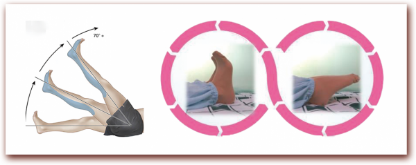 腰椎術後注意事項