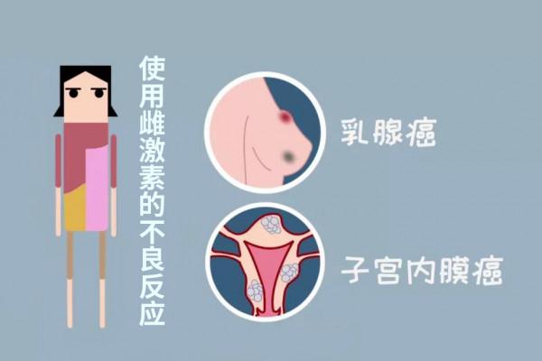 女性50歲後雌激素缺乏容易骨質疏鬆，可補充這些雌激素藥物