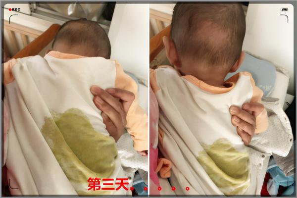 給寶寶新增蔬菜泥米糊，這四個問題，家長一定要注意