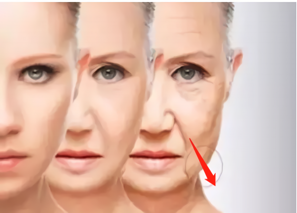 那些“一刀切”削臉的明星還好嗎？有的已垮掉，小方臉成最後贏家