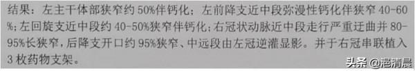 麝香保心丸治療不穩定型心絞痛的思考