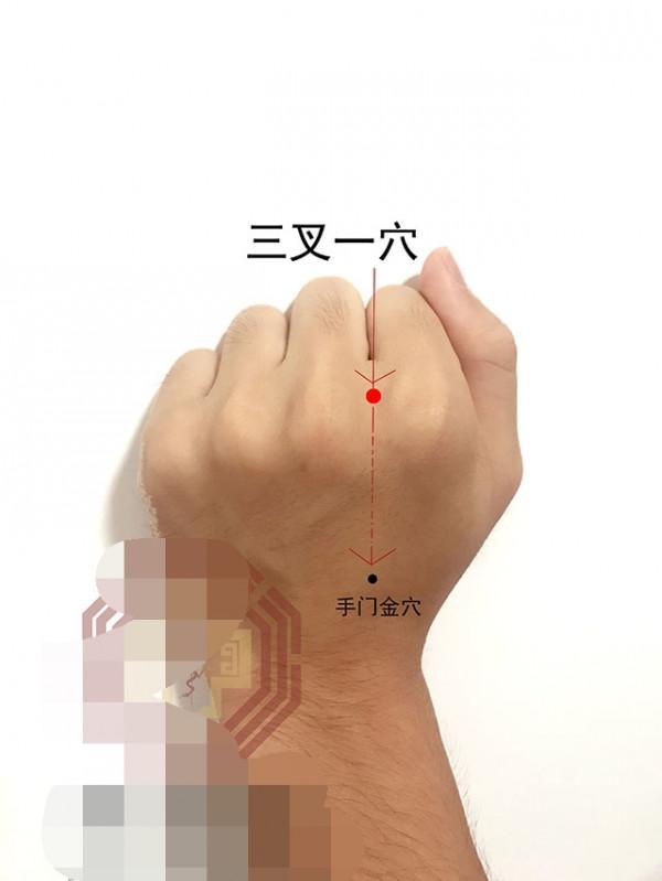 中醫針灸頸部疾病處方1