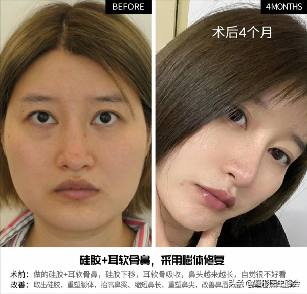 12種不適合做整形手術的行為，其中4種已被醫生列入“黑名單”