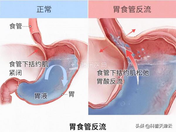 胃不好的人,儘量別吃這種藥!這4類藥才能保護你的胃 胃不好的人,儘量別吃這種藥!這4類藥才能保護你的胃