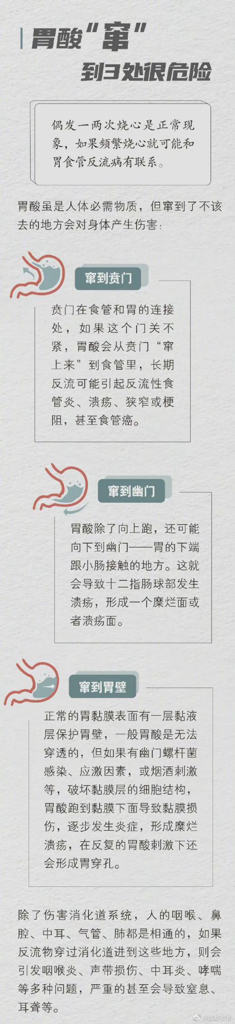 嗓子有異物感不一定是咽炎：也可能是胃食管反流！