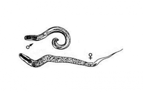 ​幾十年前男女老少體內，幾乎都長蛟蛕，為何現今很少聽說了？