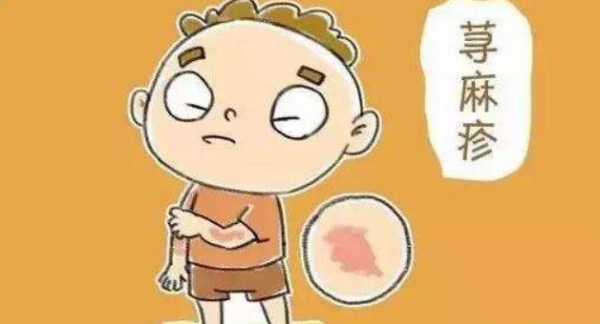風疸癢，有快速止癢的方法嗎？