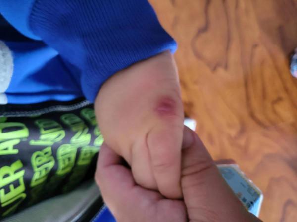 每日行一次,又帶孩子去醫院了 每日行一次,又帶孩子去醫院了