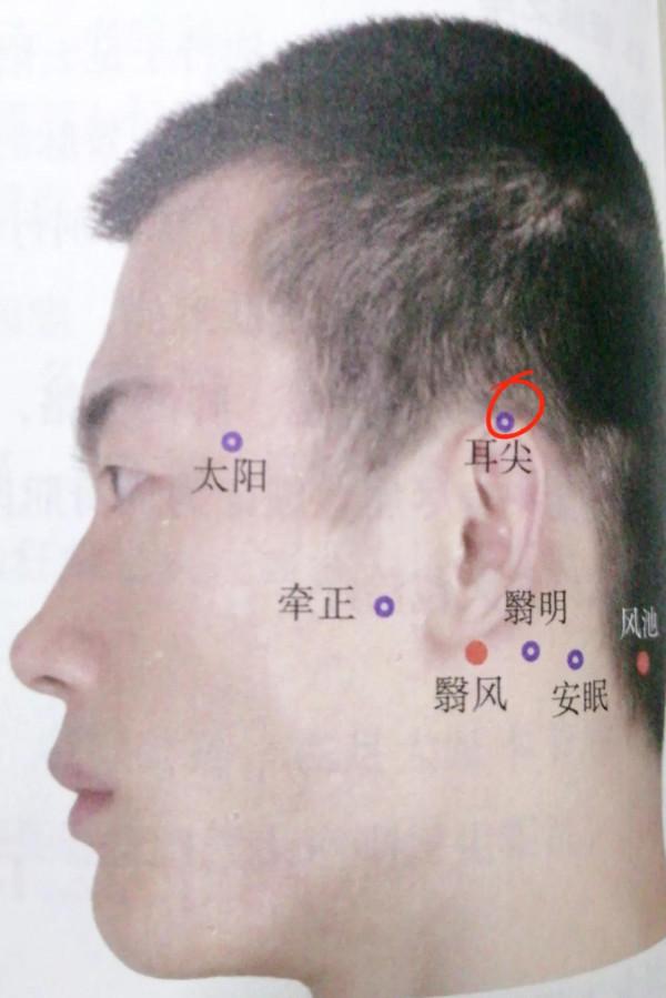 每日一穴&mdash;&mdash;耳尖穴
