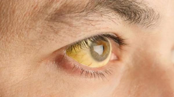 長期服藥的人，當心藥物性肝損傷！這幾種藥易傷肝，儘量別亂吃