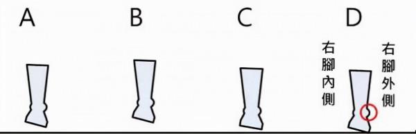 如何糾正不良體態