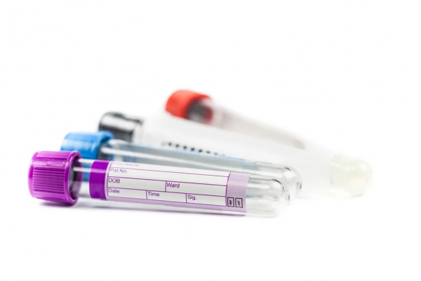 準備好了嗎？“一管血篩查癌症”模式或即將開啟