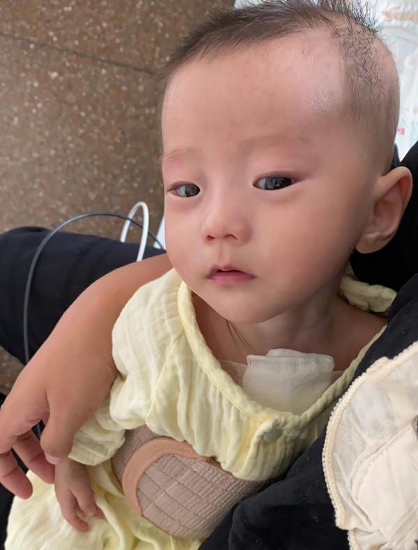 5個月產檢發現問題,夫妻不忍放棄,雙胞胎姐妹出生結果喜憂參半 5個月產檢發現問題,夫妻不忍放棄,雙胞胎姐妹出生結果喜憂參半