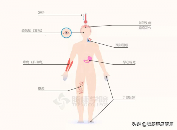 頸部痙攣的症狀與緩解 頸部痙攣的症狀與緩解