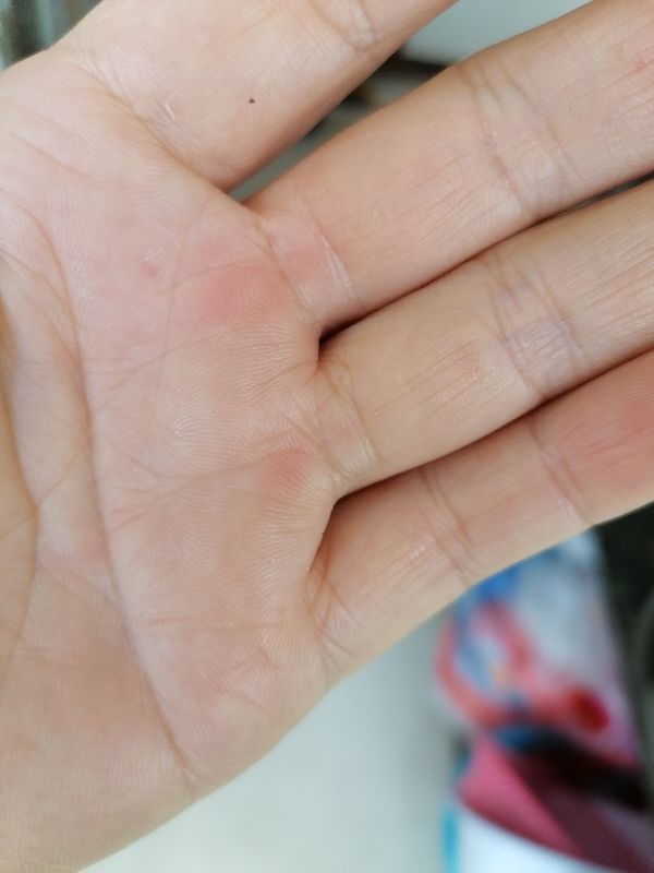 大家平時有沒有遇到瓶蓋很難開啟的那種？